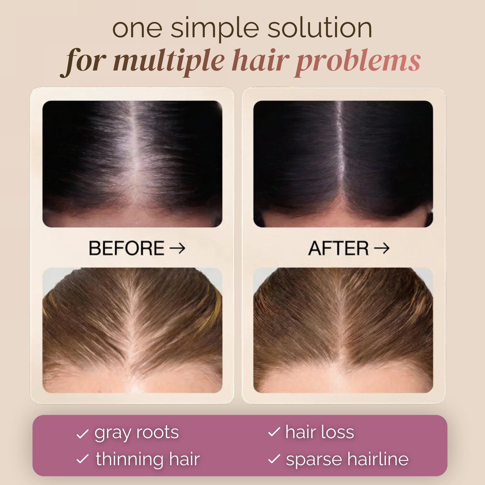 One simple solution for grey roots, thinning hair and sparse hairline